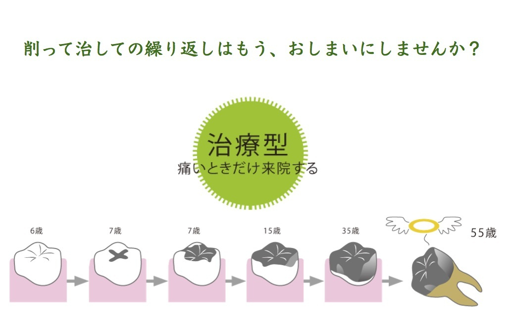 予防歯科について 鶴岡市 ふみぞの歯科・矯正歯科 文園町にある歯医者です 予防歯科について 鶴岡市 ふみぞの歯科・矯正歯科 文園町にある歯医者です
